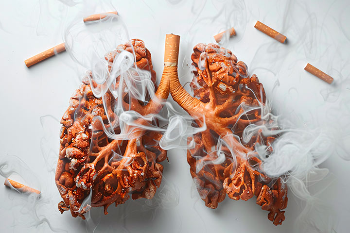 Pulmones de fumador enfermos